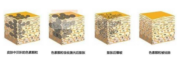 去掉脸上痣的小妙招都有哪些?